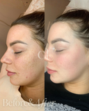 Pigment Reset